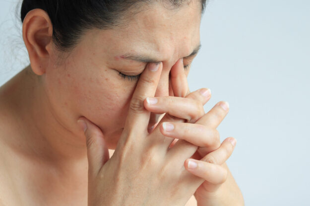 Woman,Face,With,Sinusitis,Or,Sinus,Pain,,Health,Concept